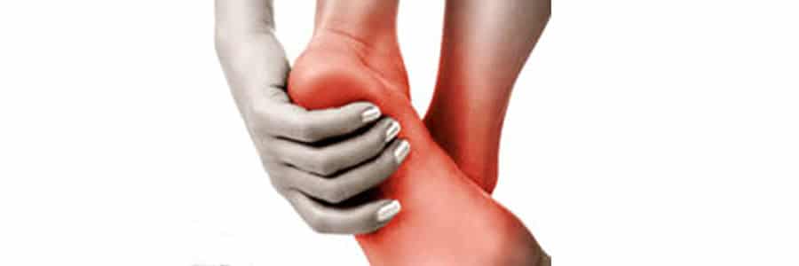 Heel-Spur-Treatment-Methods-Feet deformities